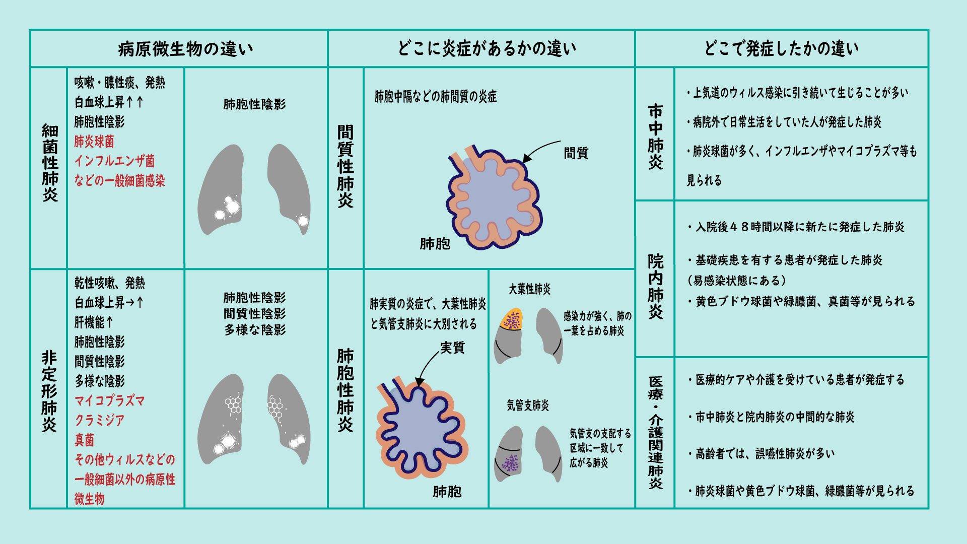 肺炎 の 種類